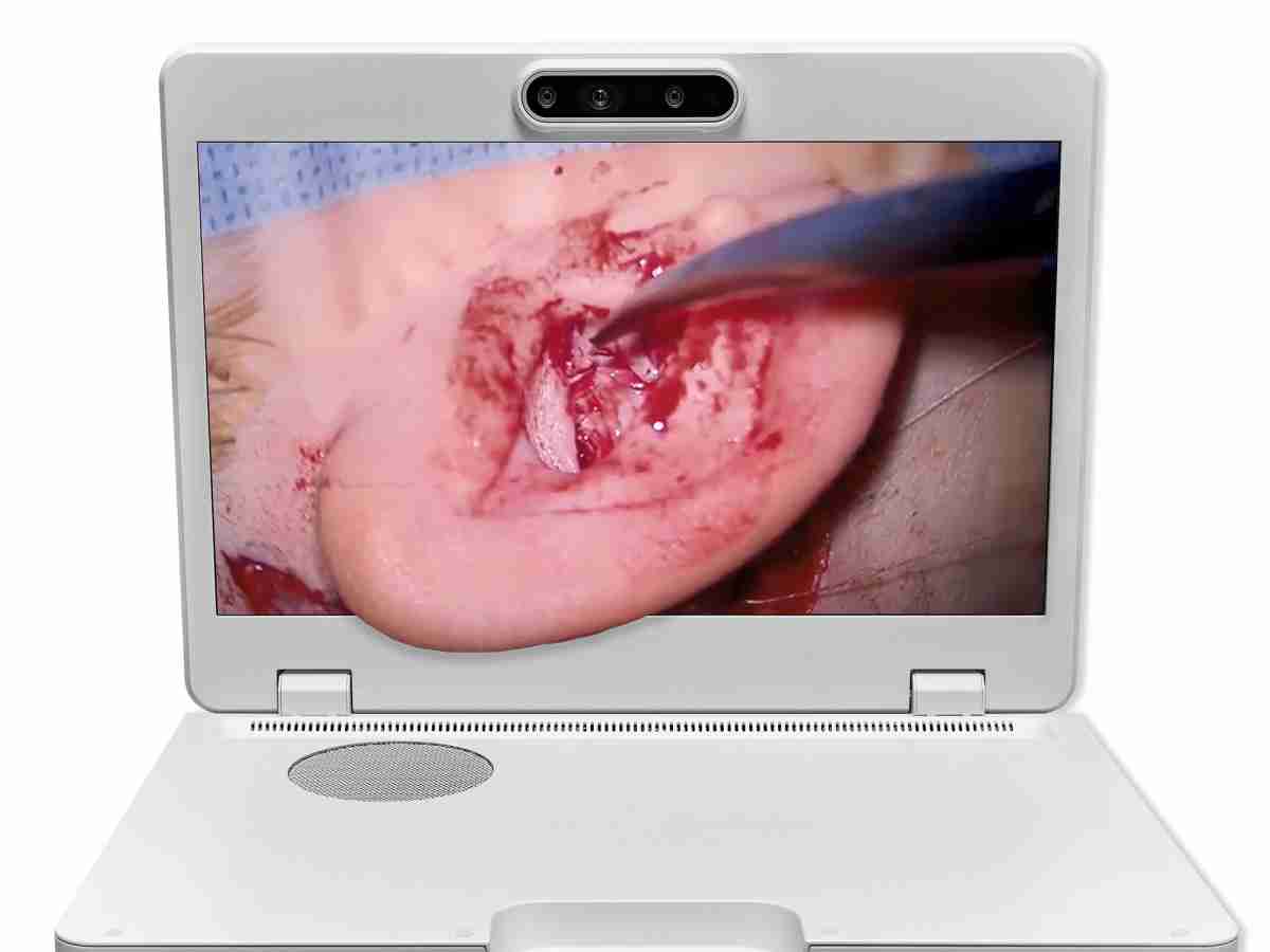 达擎之＂Heads-up 3D显微手术显示系统＂，，整合4K裸眼3D显示及眼球追踪系统，，具备快速追踪人眼移动位置功能，，减轻医师长时间维持固定姿势的负担，，让医师能有更宽广清晰的3D立体视野及更舒适的姿势来执行手术。。